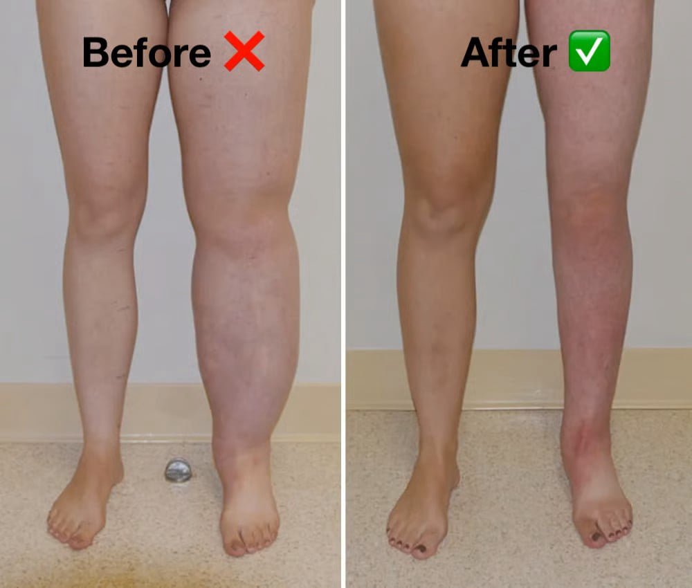 Terra Grounding Mat 15